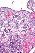 Proliferative phase endometrium -- low mag.jpg