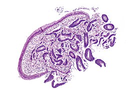 Endometrial and endocervical epithelium - low mag.jpg