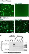 Aberrant-Expression-of-Interleukin-1β-and-Inflammasome-Activation-in-Human-Malignant-Gliomas-pone.0103432.g005.jpg