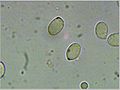 spores