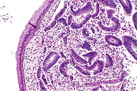 Endometrial and endocervical epithelium - intermed mag.jpg