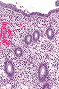 Proliferative phase endometrium -- intermed mag.jpg