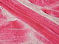 Skeletal muscle - longitudinal section