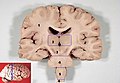 Human brain frontal (coronal) section description