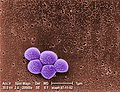 Micrografía (Microscopio electrónico) Color