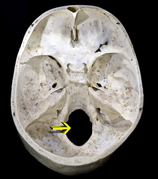 Foramen magnum