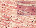 Cardiac muscle