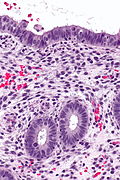 Proliferative phase endometrium -- high mag.jpg