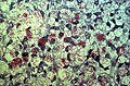 Ziehl-Nielsen stain of Mycobacterium leprae