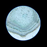 Tracheophyta stem (microscopic mage) 0005767M.jpg