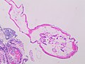 Cross-section of enterobius vermicularis - intermediate magnification