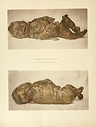 Illustrated Medicine and Surgery (1888) (14784247353).jpg