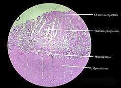 Secretory endometrium.jpg