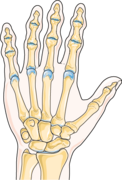 Rheumatology - Osteoarthritis 1 -- Smart-Servier.png