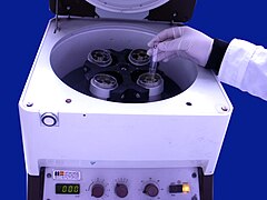 Urine Centrifugation.jpg