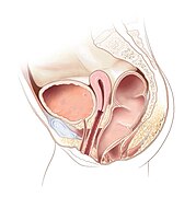 Rectoperineal fistula - Position 2.jpg