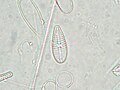 Gomphonema olivaceum