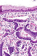 Endometrial and endocervical epithelium - high mag.jpg