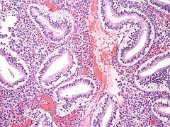 Endometrium Secretory-Type Endometrium 10x1.JPG