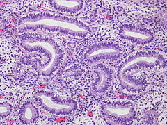 Endometrium Secretory 20x1.jpg