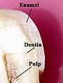 Labeled anterior tooth in cross-section