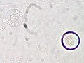 Cyclotella radiosa