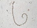 Anabaena sp.