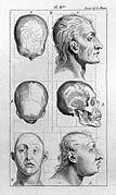 Six pictures of crania and heads of the insane. Wellcome L0016100.jpg