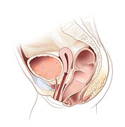 Rectovestibular fistula - Position 1.jpg