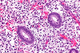 Proliferative endometrium - very high mag.jpg