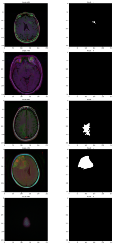 MRI and mask