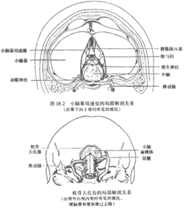 腦疝顱內壓增高