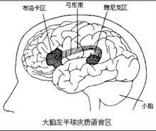 布洛卡區en211