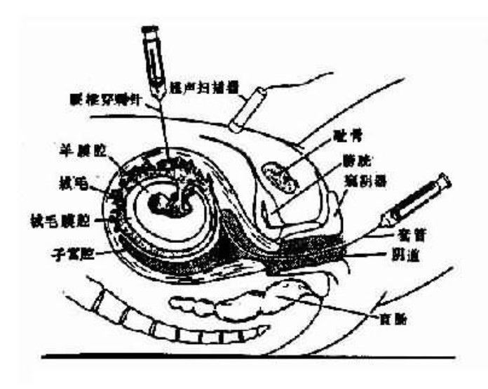 凝血因子