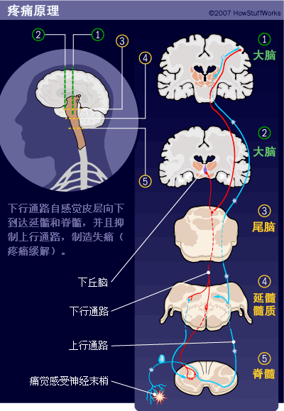 疼痛原理