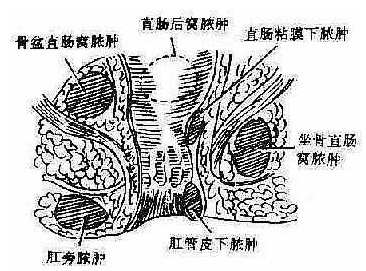 肛門直腸疾病