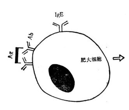 Ⅰ型變態反應示意圖