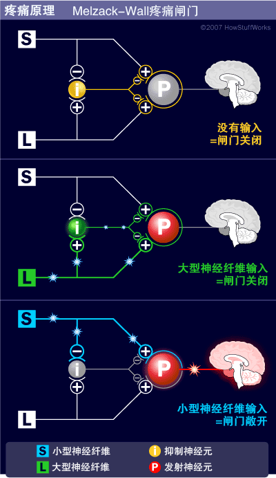 疼痛原理-疼痛的閘門控制理論