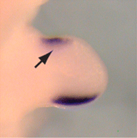 Preaxial polydactyly: ectopic Shh-expression, Hemingway mutant, mouse, right forelimb