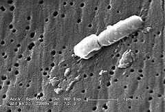 Klebsiella pneumoniae, мікрофотографія за допомогою ТЕМ