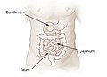 Ileum II