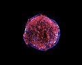 Tycho Supernova remnant in X-ray light