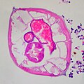 Micrografía a grande aumento dun oxiúro nun corte transversal do apéndice. Tinguidura de hematoxilina-eosina.