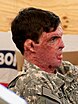 The image shows a man (Sam Brown) in profile wearing a U.S. Army combat uniform with an American flag patch on the shoulder. The individual has dark hair and extensive burn scarring on their face, neck, and ear area, which has affected the skin texture and pigmentation.
