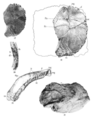 Skulls IV and V