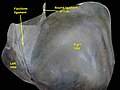 Round ligament of liver. Superior surface of liver.