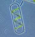 Single Spirogyra cell