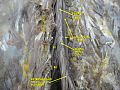 Spinal cord. Spinal membranes and nerve roots. Deep dissection. Posterior view.