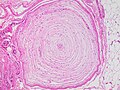 Micrograph of a Pacinian corpuscle