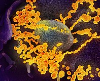 Wiriony SARS-CoV-2 wydobywające się z ludzkiej komórki
